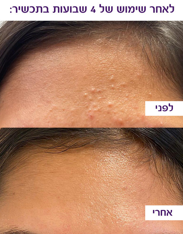 קרם ג'ל STAR SWEEPER